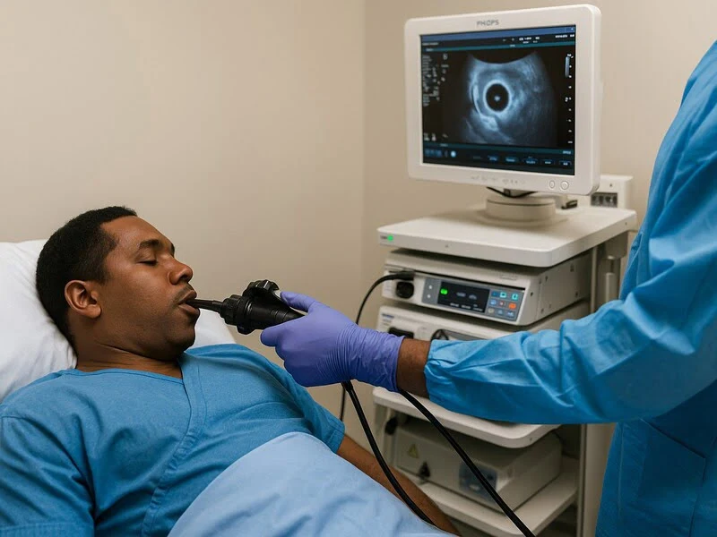 Echo endoscopie