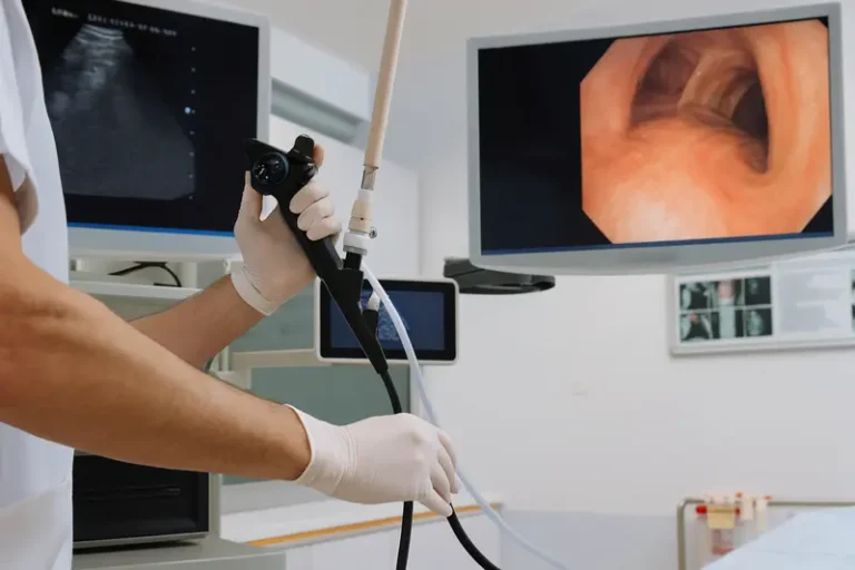 Echo endoscopie